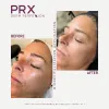 WIQO PRX PLUS | 5 Flaconi da 4ml - 2